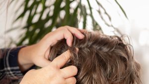 Parent's hands carefully parting a school-aged child's hair near the scalp under bright natural light, the literal at-home moment when a Montgomery County parent is trying to tell whether the white specks they are seeing are dandruff or lice nits.