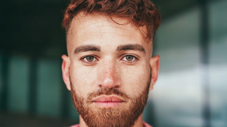 Head Lice in Beards: What Dads Should Know