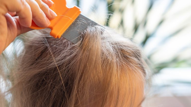 How to Tell If the Speck on Your Finger Is a Lice Egg