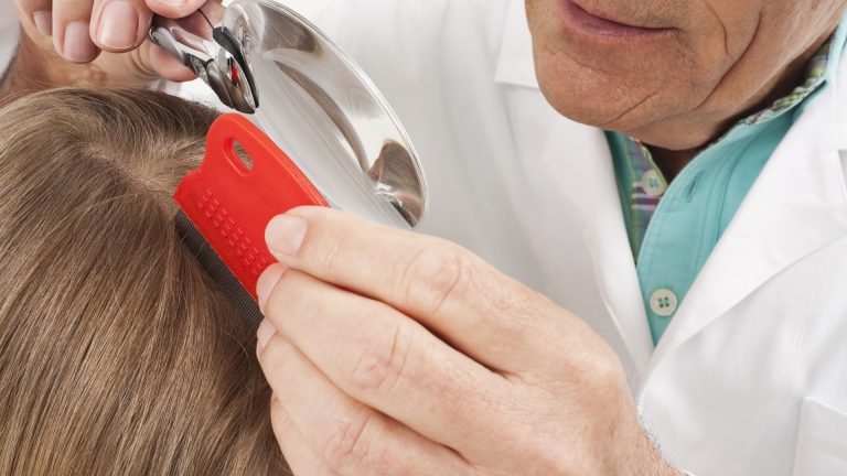 What Does an In-Home Lice Visit Miss That a Clinic Catches?