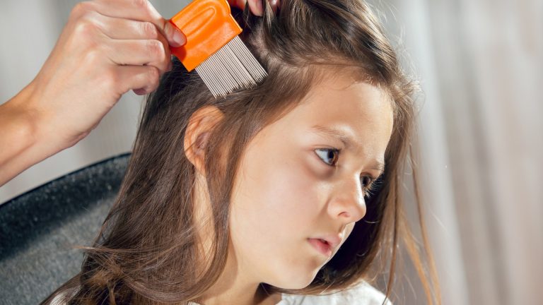 Blonde or Dyed, Kids Still Catch Head Lice