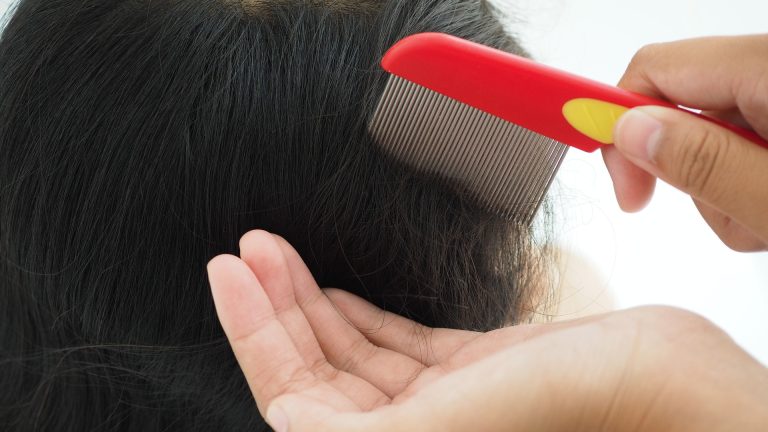 Get Ahead of Head Lice Before the School Year Starts