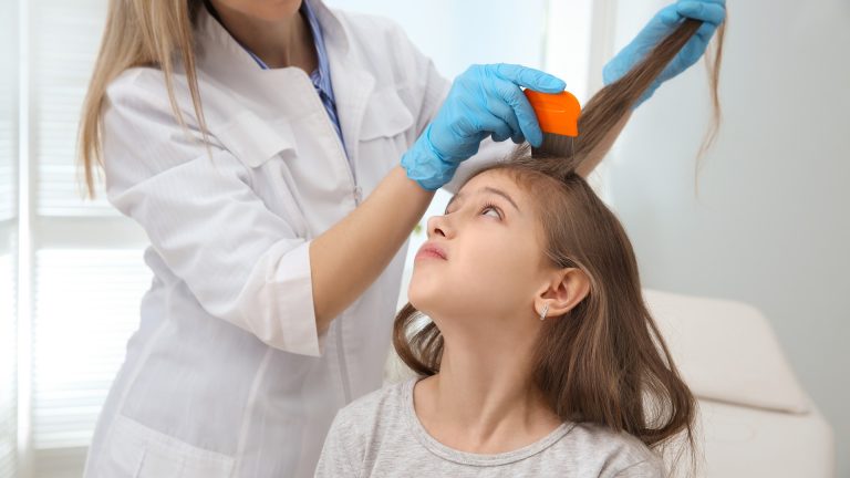 Getting Rid of Lice for Good Is a Process, Not a Product