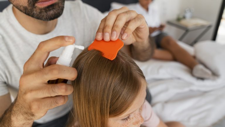 Resistance Is Rarely Why Your Lice Treatment Failed