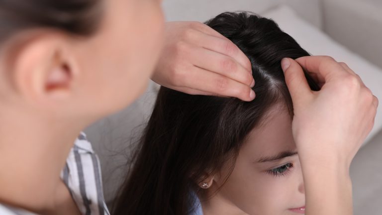 The First Move After Finding Lice Isn’t Cleaning House