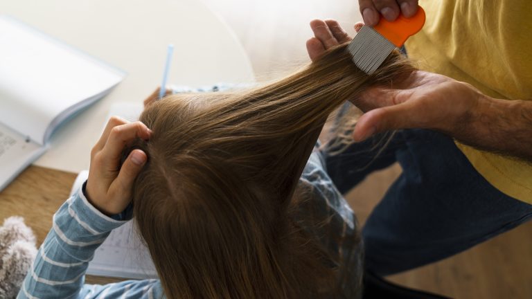Your Scalp Is the Least Reliable Lice Test You Have