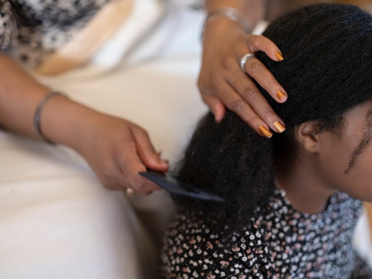 Can Head Lice Cause Hair Loss in Children?
