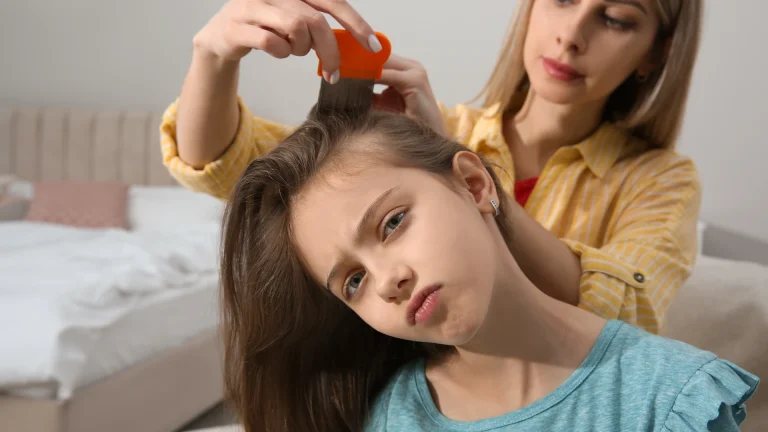 Black light or comb check? What confirms lice in Blue Bell